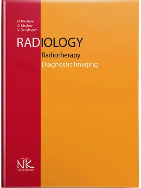 Radiology. Radiotherapy. Diagnostic Imaging/Радіологія. Променева терапія. Променева діагностика. 2-ге вид. Ковальський О. В .та ін. Radiology. Radiotherapy. Diagnostic Imaging/Радіологія. Променева терапія. Променева діагностика. 2-ге вид. Ковальський О. В .та ін.
