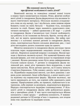 Інклюзивне навчання. Дитина із синдромом Дауна