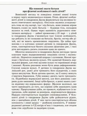 Інклюзивне навчання. Дитина із синдромом Дауна