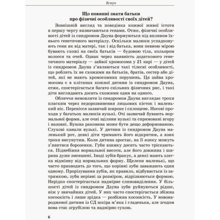 Інклюзивне навчання. Дитина із синдромом Дауна