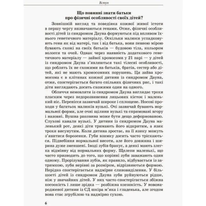 Інклюзивне навчання. Дитина із синдромом Дауна