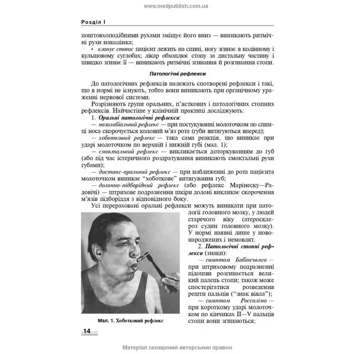 Неврологія: підручник. Наталія В. Литвиненко, Таїсія І. Кареліна, Ніна М. Касевич
