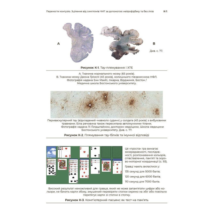 Победить контузию. Исцеление от симптомов ЧМТ с помощью нейрофидбека и без лекарств. Мэри Ли Эсти, Кэрол М. Шиффлетт